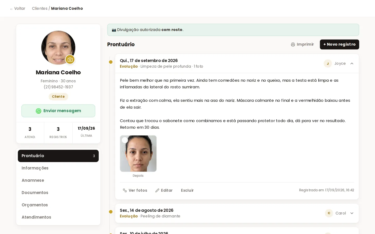 Ficha da cliente com o prontuário aberto, as anotações da última limpeza de pele e a foto do atendimento. Pessoa fictícia, foto gerada por IA para demonstração